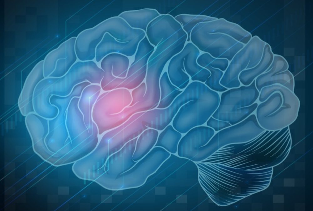 How to Detect a Stroke FAST Part I
