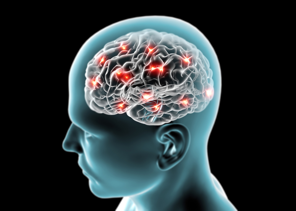 How to spot stroke fast