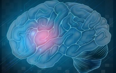 How to detect a stroke FAST Part 2