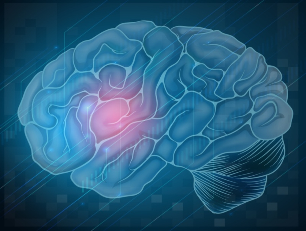 how to prevent stroke