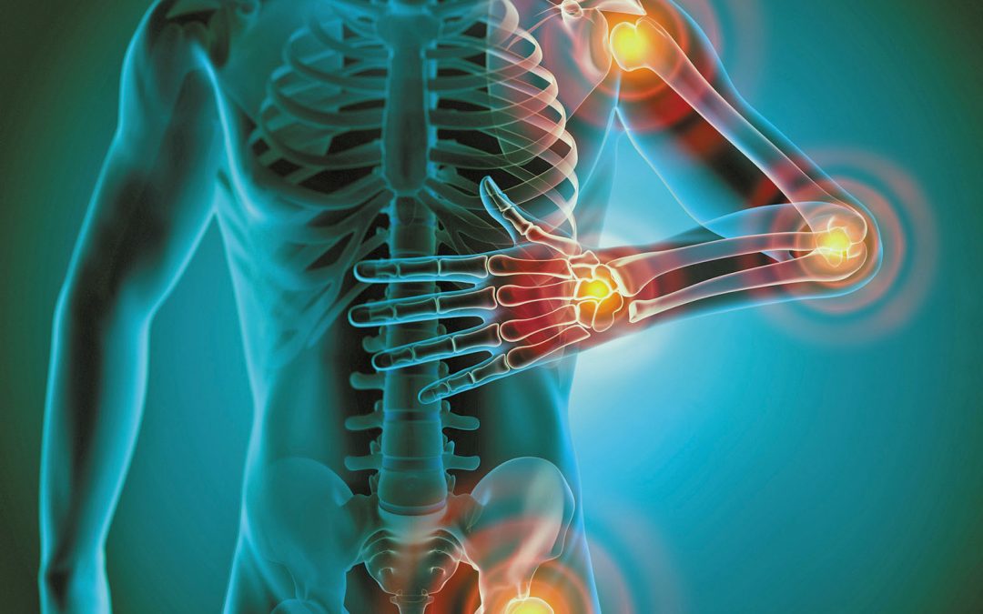Fight Health-Robbing Inflammation! with 7 Simple Steps