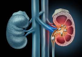 best urologist in nigeria