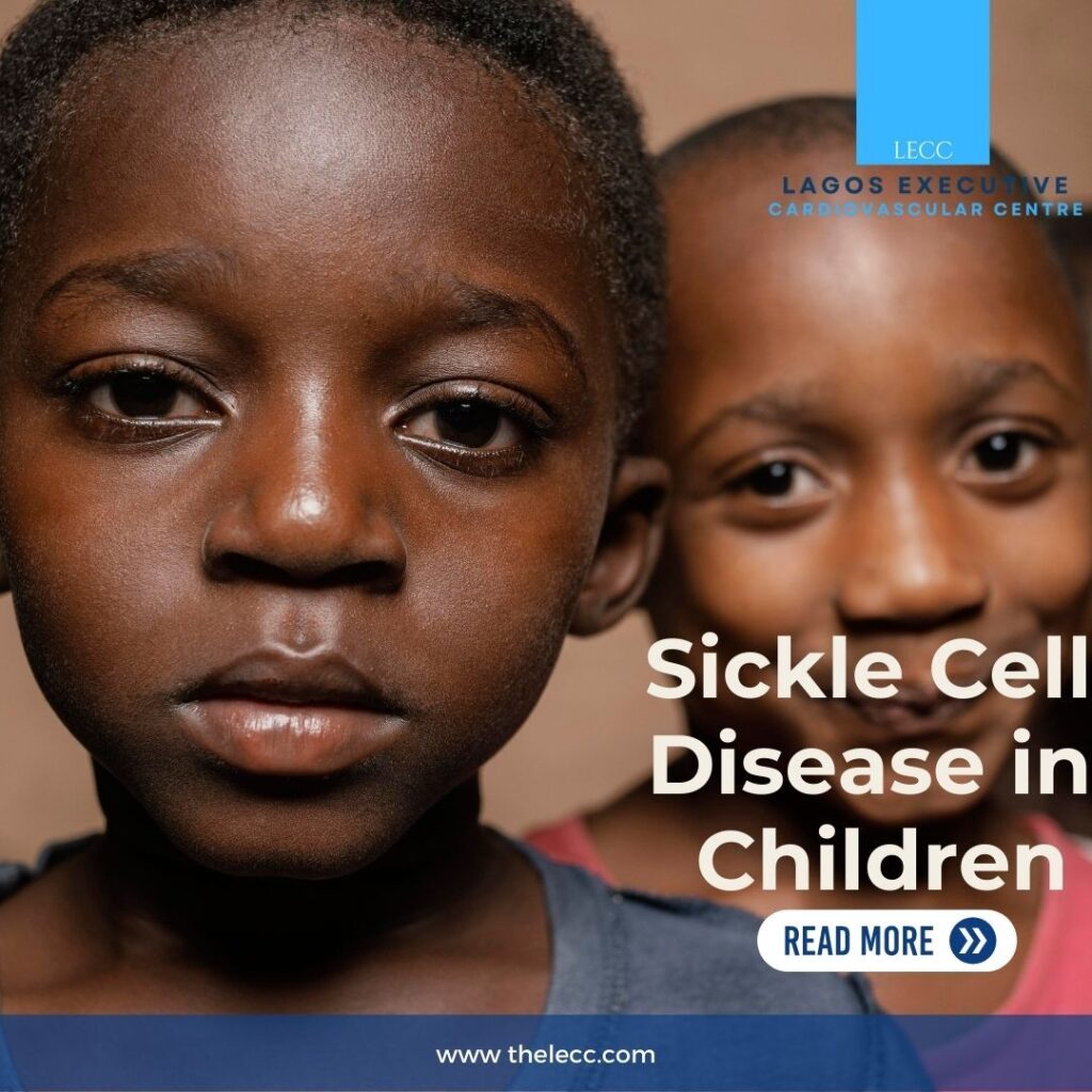 Sickle Cell Disease