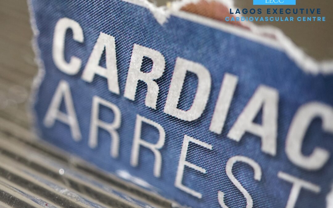 Cardiac Arrest: Understanding the Emergency and Saving Lives