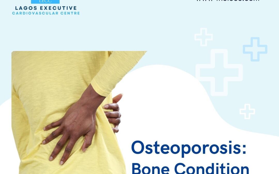 Osteoporosis: Understanding, Preventing, and Managing Bone Health