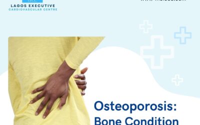 Osteoporosis: Understanding, Preventing, and Managing Bone Health