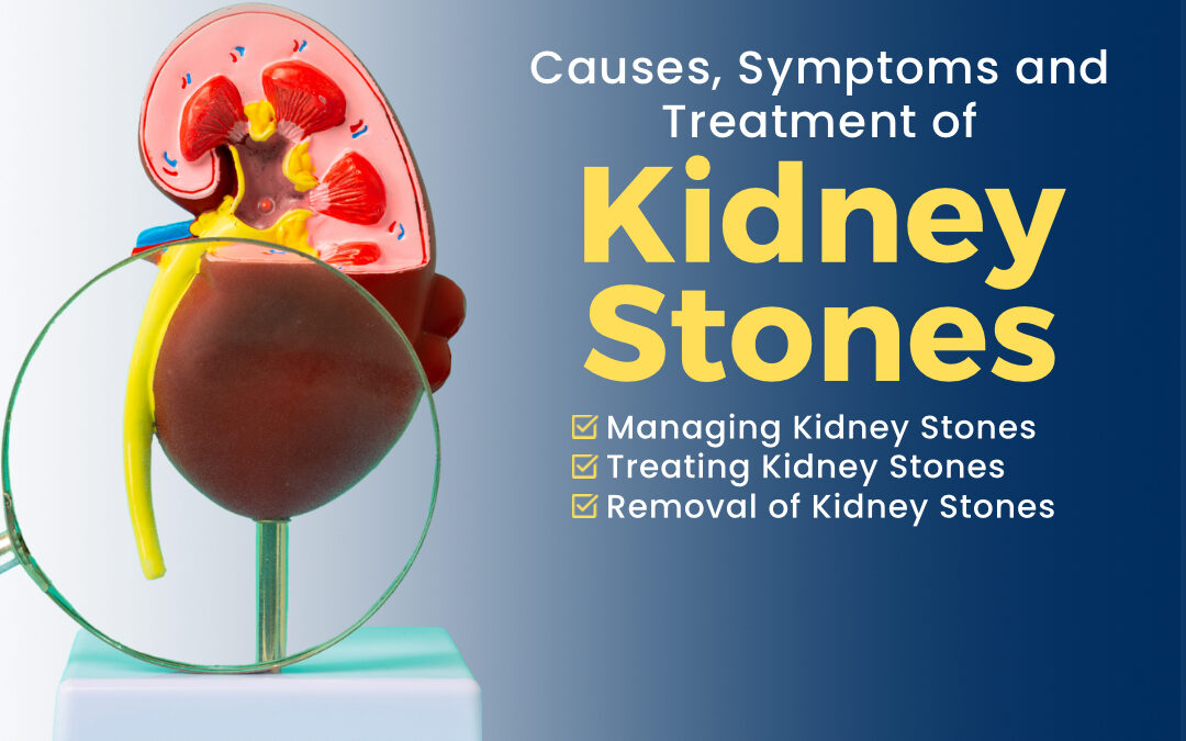 Kidney Stones: Causes, Symptoms, and Advanced Treatment Options