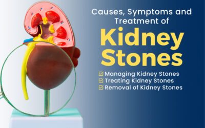 Kidney Stones: Causes, Symptoms, and Advanced Treatment Options