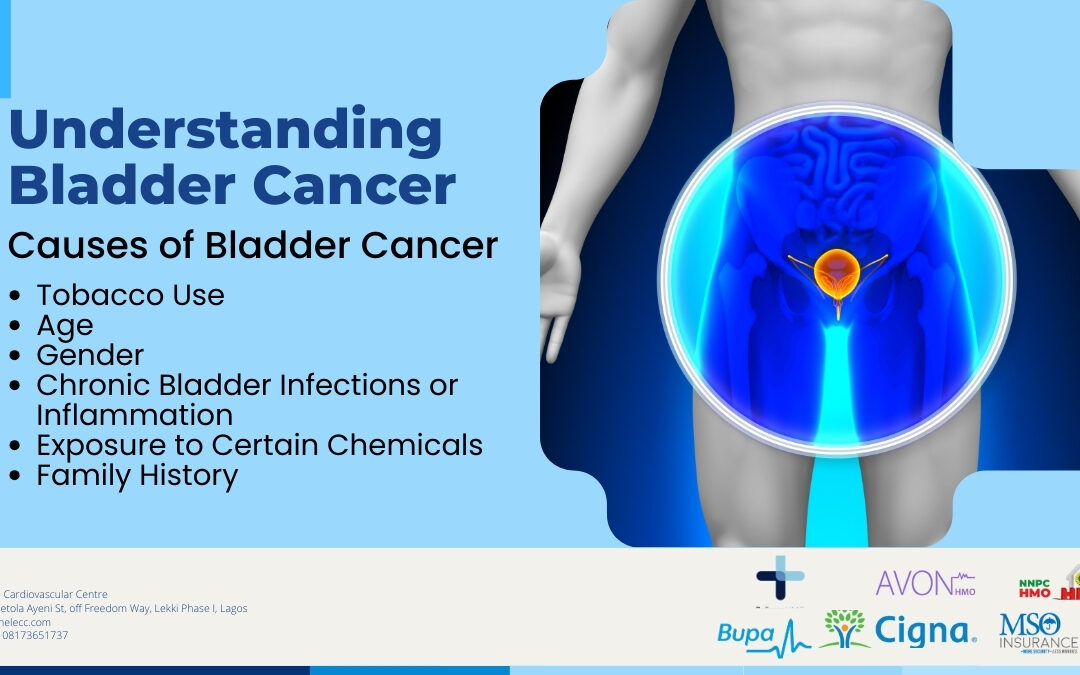 Understanding Bladder Cancer: Symptoms, Causes, Treatment, and Prevention