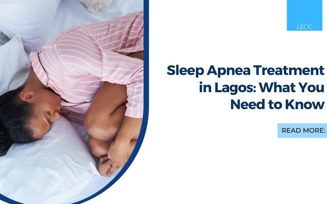 Sleep Apnea Treatment in Lagos: What You Need to Know